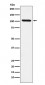 Anti-DDX58 Monoclonal Antibody